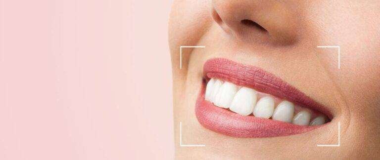 Best Orthodontist in Bangalore