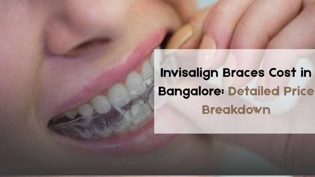 Invisalign Braces Cost in Bangalore
