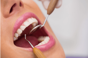 Read more about the article Why should I schedule regular dental checkups?