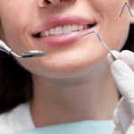 How Do Dental Veneers Transform Your Smile and Confidence?
