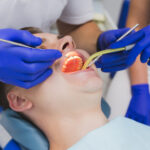 How to Choose the Best Clinic for Laser Root Canal Treatment in Bangalore