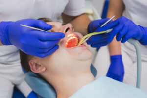 Read more about the article How to Choose the Best Clinic for Laser Root Canal Treatment in Bangalore