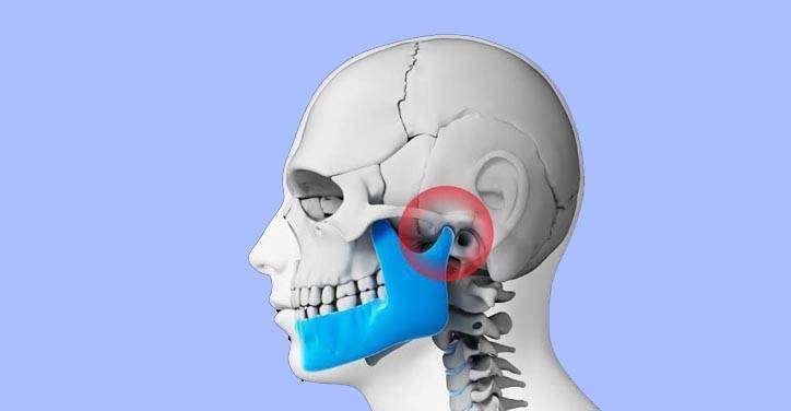 TMJ disorders
