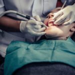 Painless Laser Single Visit Root Canal Treatment in Bangalore