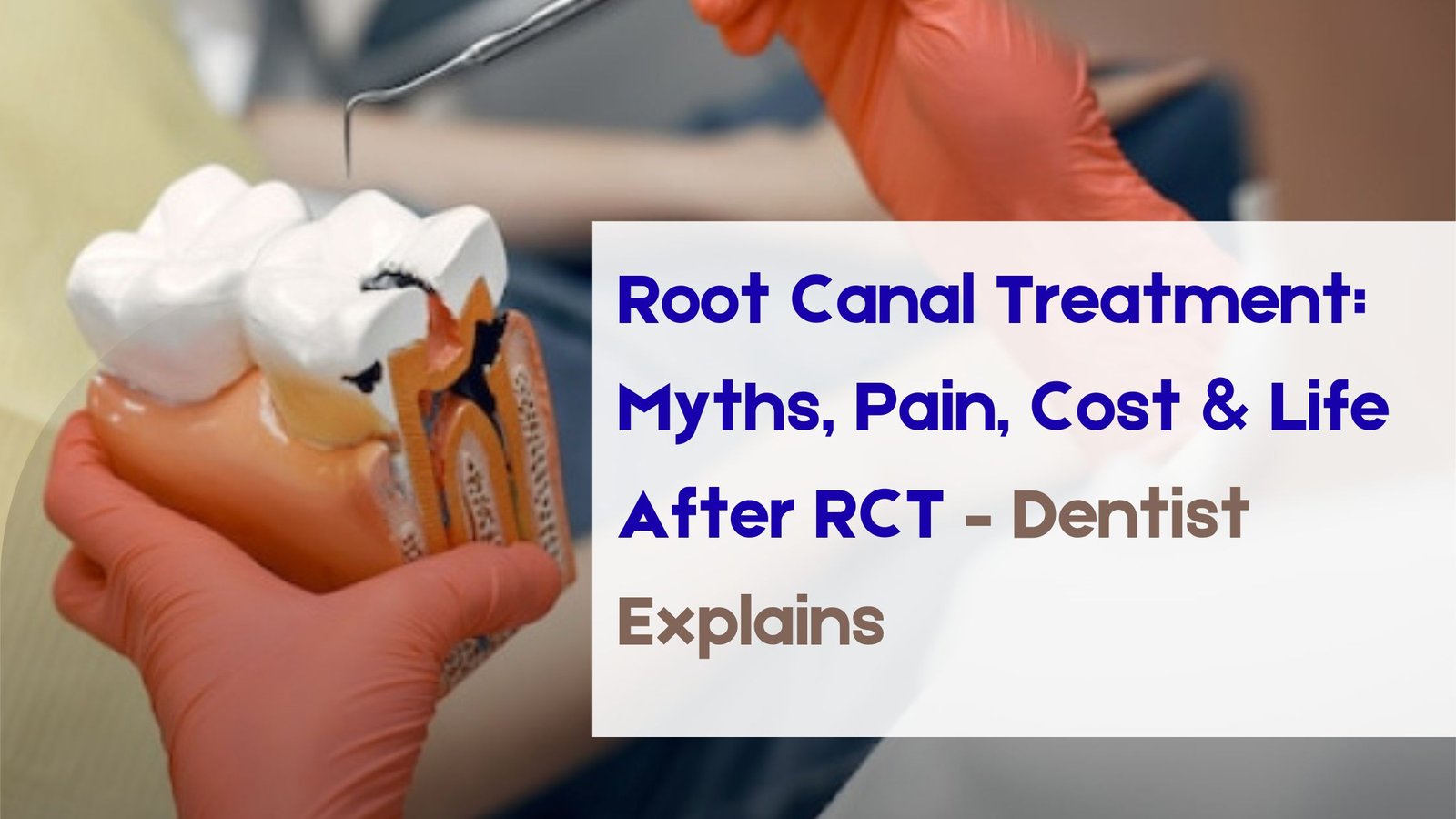 You are currently viewing Root Canal Treatment: Myths, Pain, Cost & Life After RCT – Dentist Explains