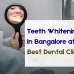 Teeth Whitening Prices in Bangalore at the Best Dental Clinic