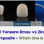 Dental Veneers: Emax vs Zirconia vs Composite – Which One Is Best?