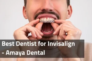Best Dentist for Invisalign