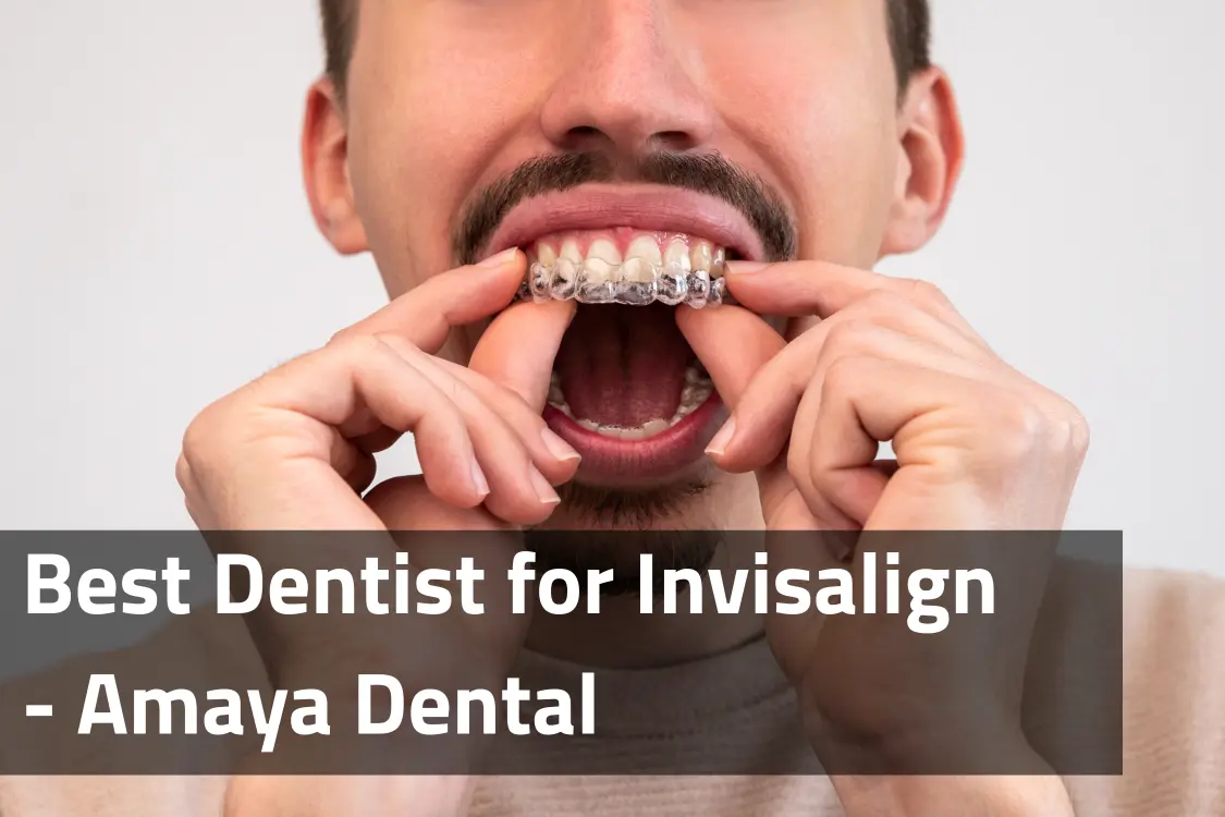 You are currently viewing Best Dentist for Invisalign: Why Amaya Dental Is the Clear Choice for Your Smile Transformation