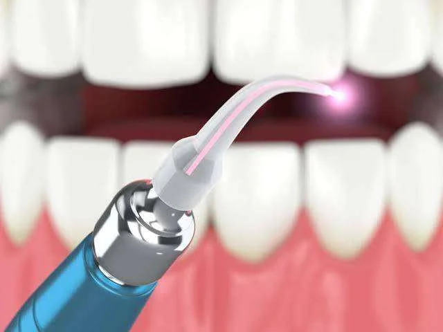 You are currently viewing LASER TEETH WHITENING IN BANGALORE