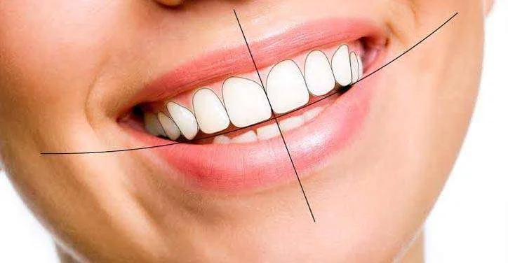 Digital Smile Designing in Bengalore