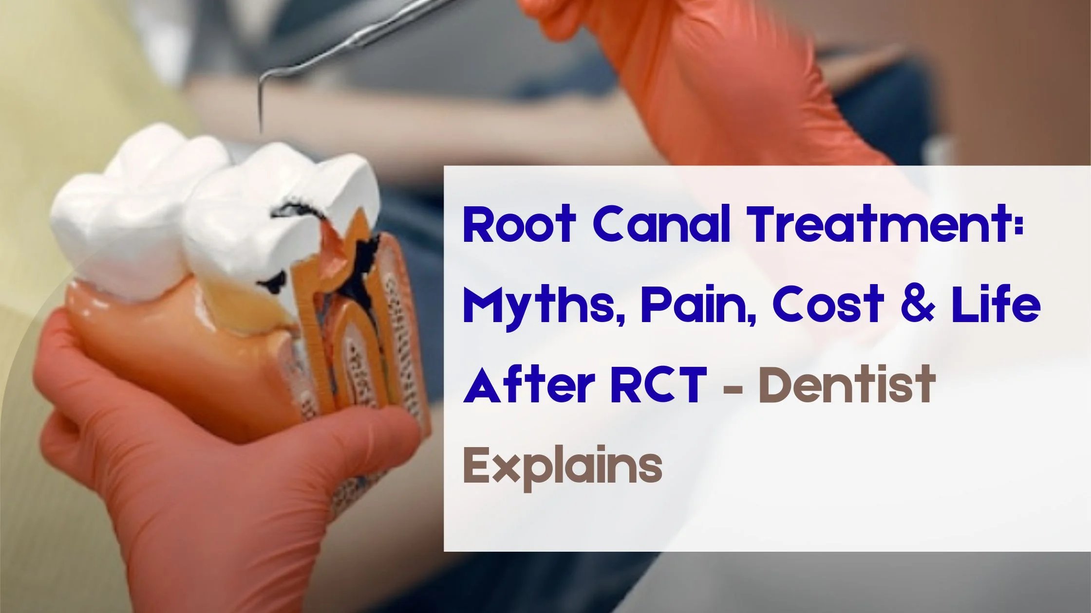 Read more about the article Root Canal Treatment: Myths, Pain, Cost & Life After RCT – Dentist Explains